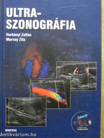 PROF. DR. HARKÁNYI ZOLTÁN – DR. MORVAY ZITA: ULTRASZONOGRÁFIA